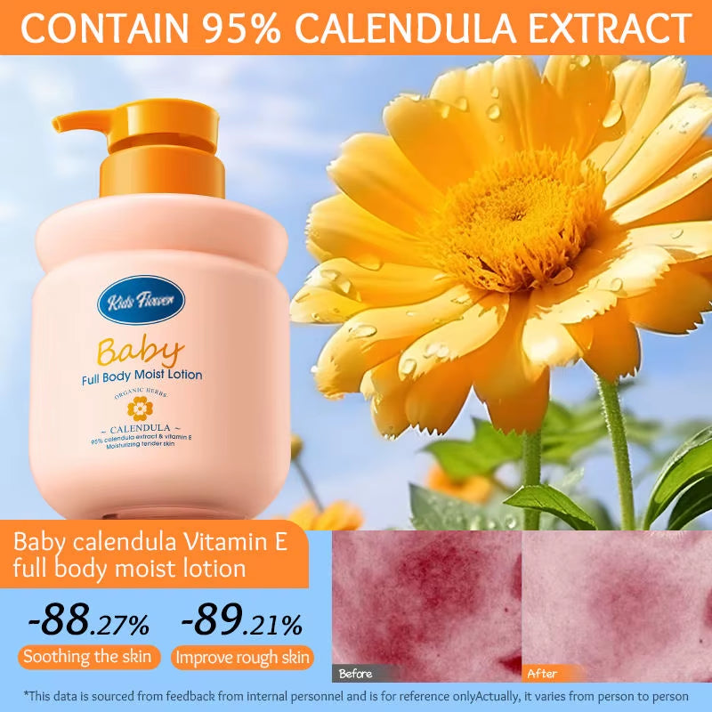 Skin Care Safety Products Children Calendula Vitamin E Soothing Improve Rough Skin Moisturizing Nourishing Baby Body Lotion