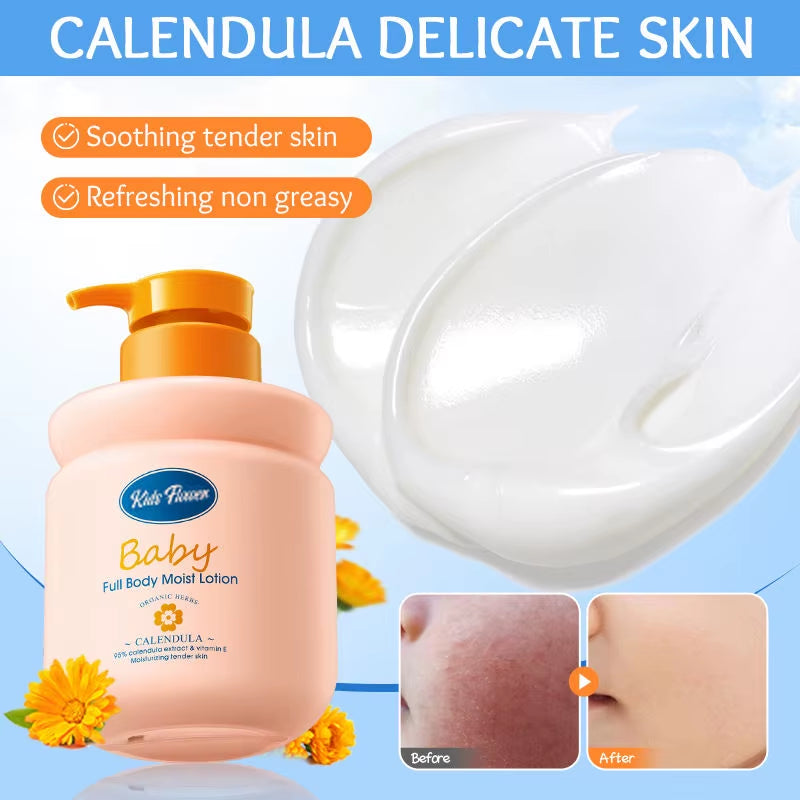 Skin Care Safety Products Children Calendula Vitamin E Soothing Improve Rough Skin Moisturizing Nourishing Baby Body Lotion