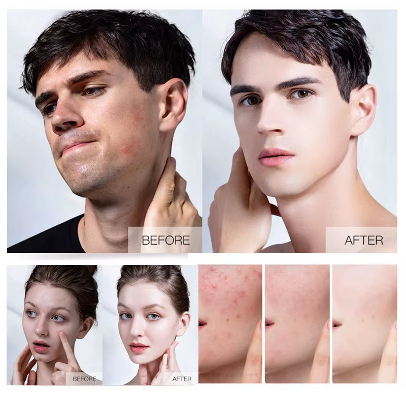 Men'S anti Acne Skin Care Set for Skin Care Manufacturer Supplier for Sale Whitening Moisturizing for Men Face Care
