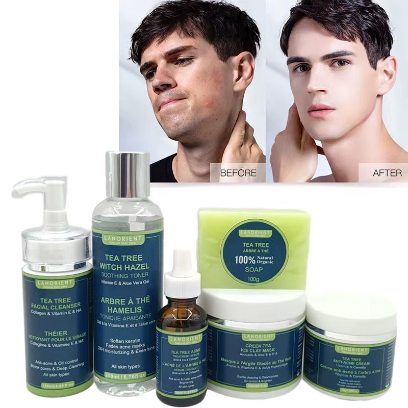 Men'S anti Acne Skin Care Set for Skin Care Manufacturer Supplier for Sale Whitening Moisturizing for Men Face Care