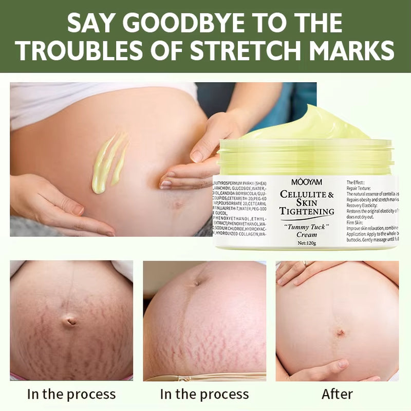 Stretch Mark Repair Cream Postpartum/Pregnancy Firming Soothing & Softening Nourishing Body Care Cream