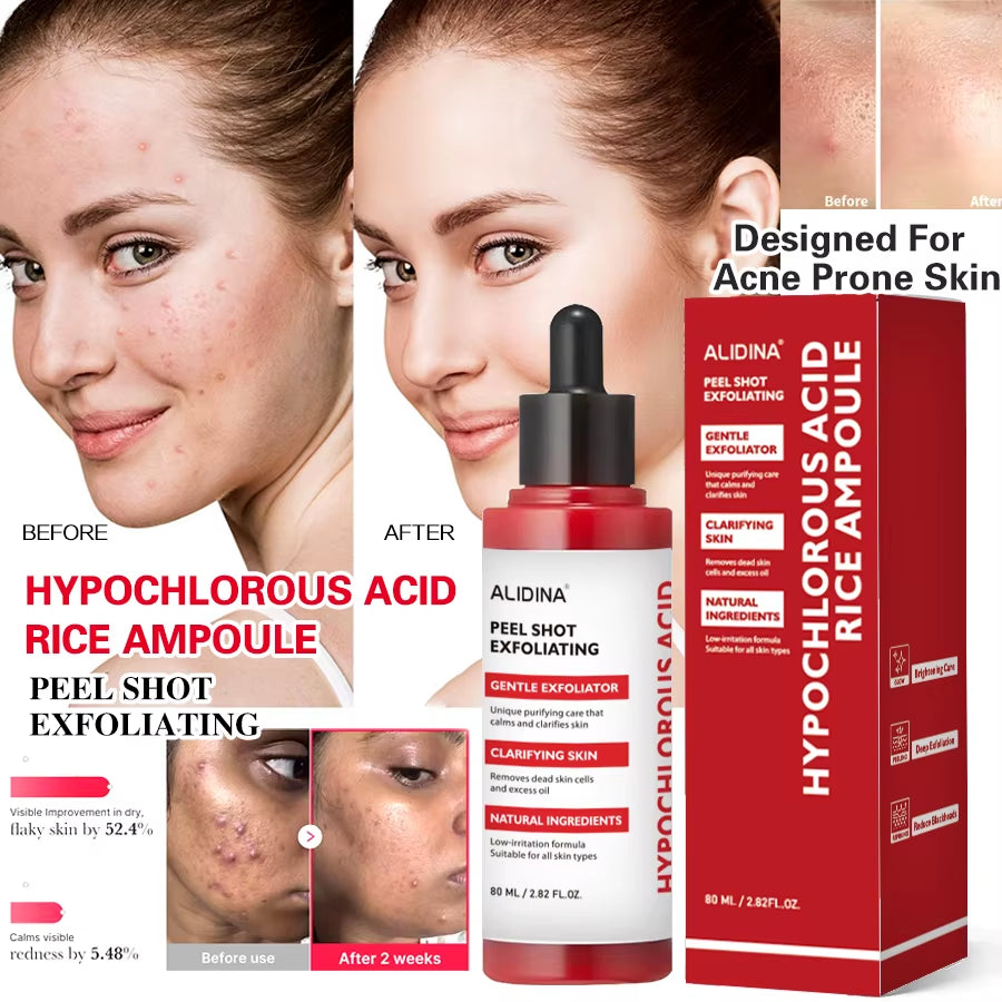 Custom Logo Sensitive Skin Redness Facial Serum Hypochlorous Face Body Soothing Hypochlorous Acid Exfoliating Peeling Acne Serum