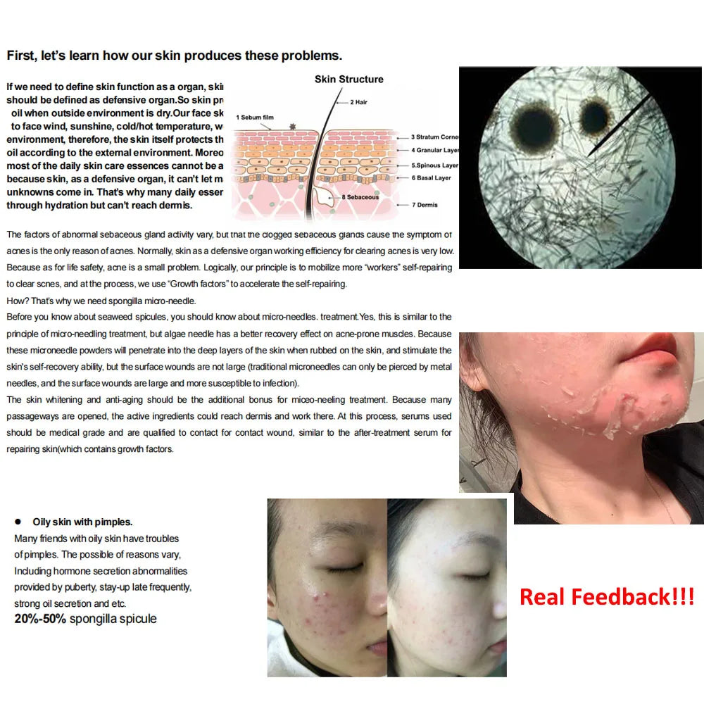 Algae Peel Family Herbal Sponge Combo Kit Hydrolyzed Spongilla Spicules Acne Remover Skin Whitening Suero Para De Algas Marinas