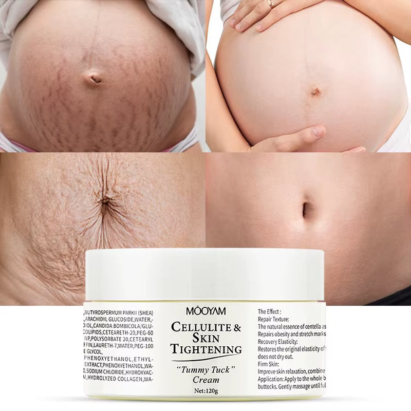 Stretch Mark Repair Cream Postpartum/Pregnancy Firming Soothing & Softening Nourishing Body Care Cream