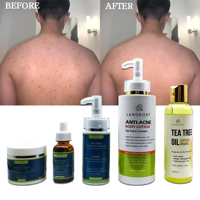 Best Selling Skin Care Product Natural Organic Vitamin C Acne Whitening and Moisturizing Face&Body Tea Tree Skin Care Set