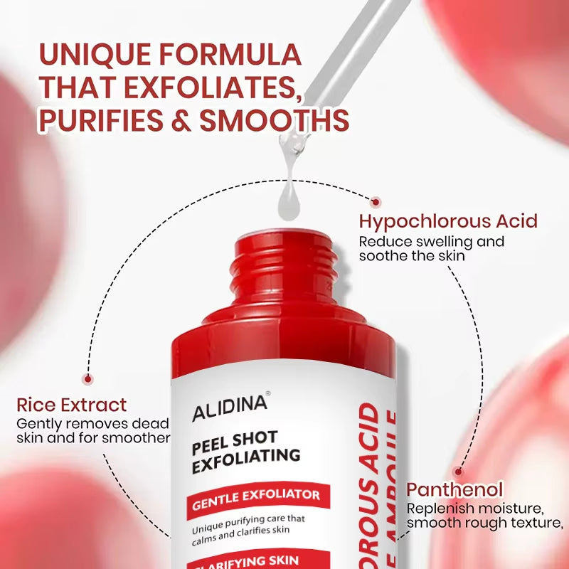 Custom Logo Sensitive Skin Redness Facial Serum Hypochlorous Face Body Soothing Hypochlorous Acid Exfoliating Peeling Acne Serum