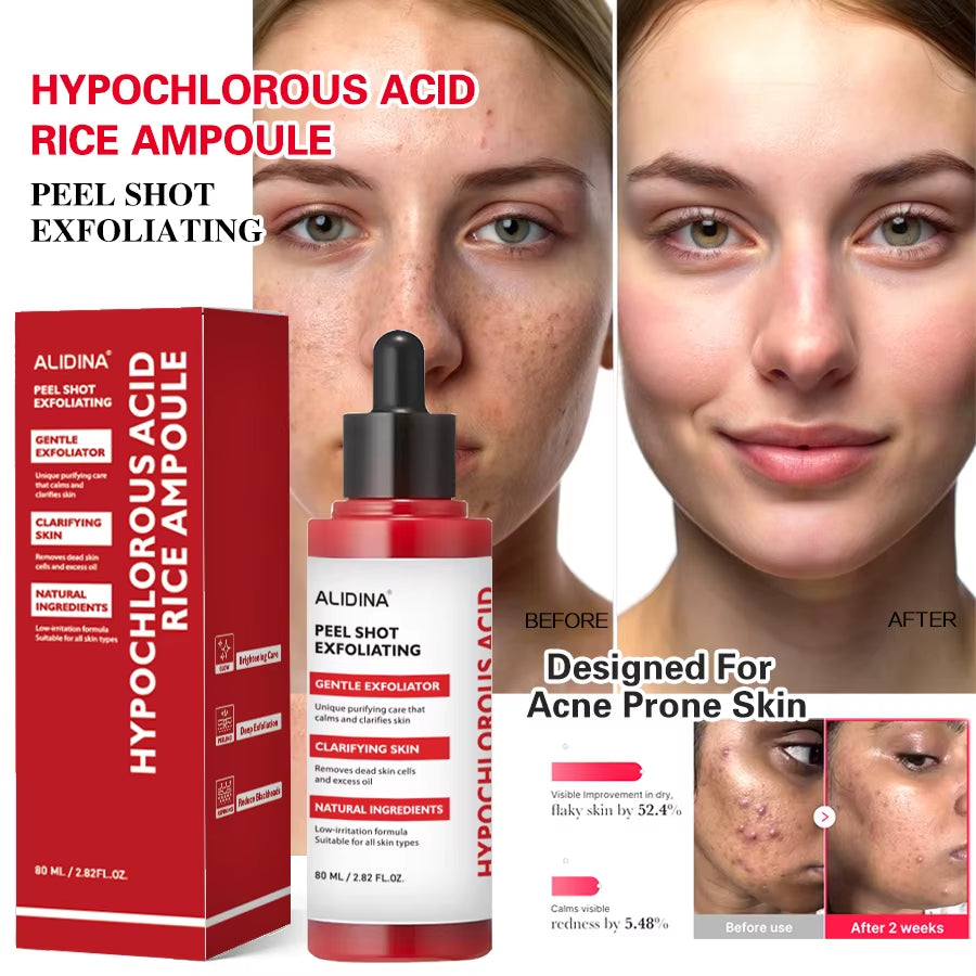 Custom Logo Sensitive Skin Redness Facial Serum Hypochlorous Face Body Soothing Hypochlorous Acid Exfoliating Peeling Acne Serum
