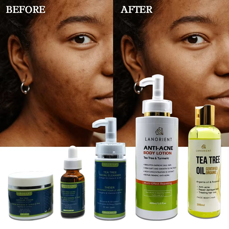 Best Selling Skin Care Product Natural Organic Vitamin C Acne Whitening and Moisturizing Face&Body Tea Tree Skin Care Set